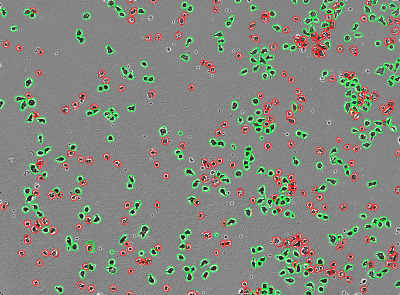 Incucyte® AI Cell Health Analysis Software Module