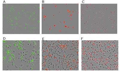 Incucyte® Cytolight Rapid Dye for Live-cell Cytoplasmic Labeling