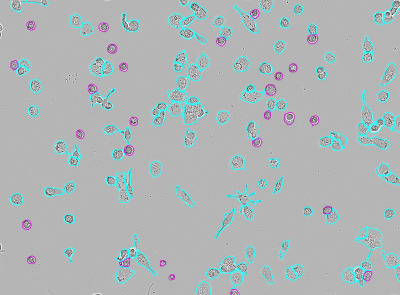 Incucyte® Advanced Label-Free Classification Analysis Software Module