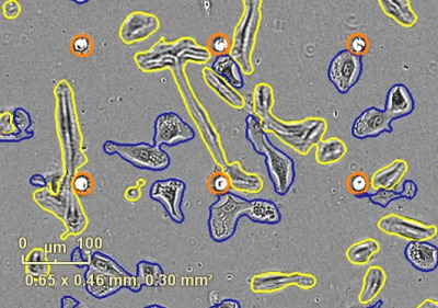 Incucyte® Chemotaxis Analysis Software Module