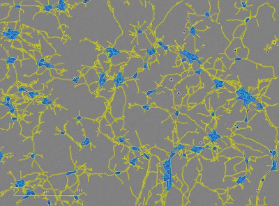 Incucyte® Neurotrack Analysis Software Module